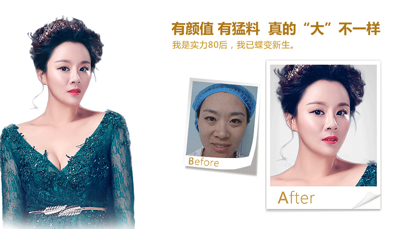 常德脂肪移植、隆鼻