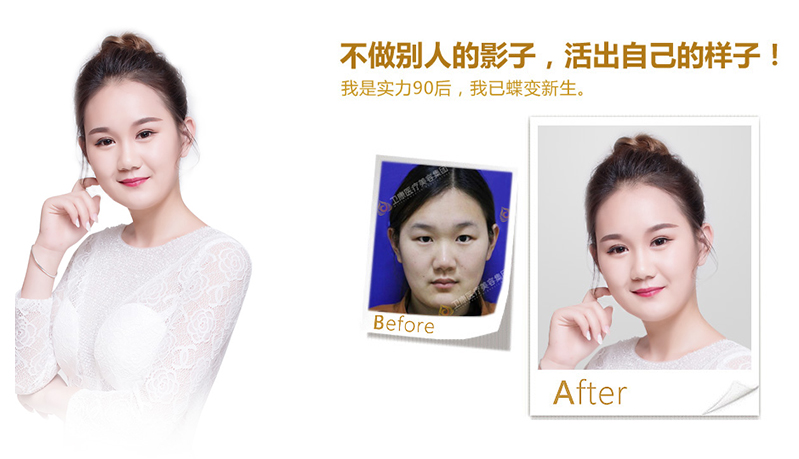 常德纳米脂肪移植