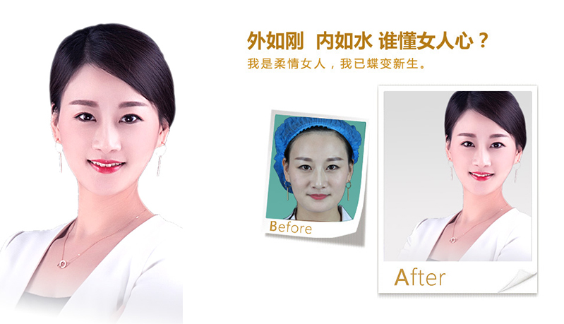 常德V脸、线雕隆鼻